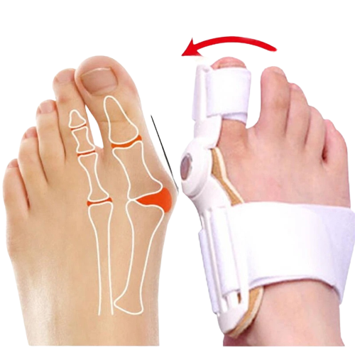 Bunion-Splint-Big-Toe-Straighten-removebg-preview.png